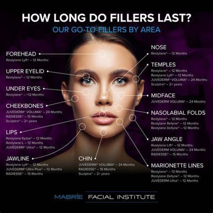 Can you put fillers in your hands?