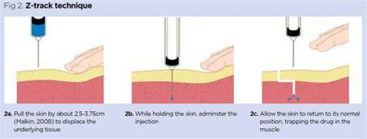 Do we aspirate for intramuscular injection?
