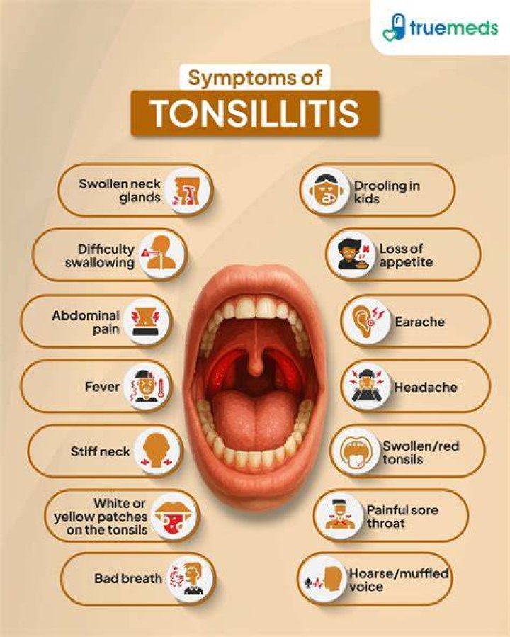 Do you get a runny nose with tonsillitis?