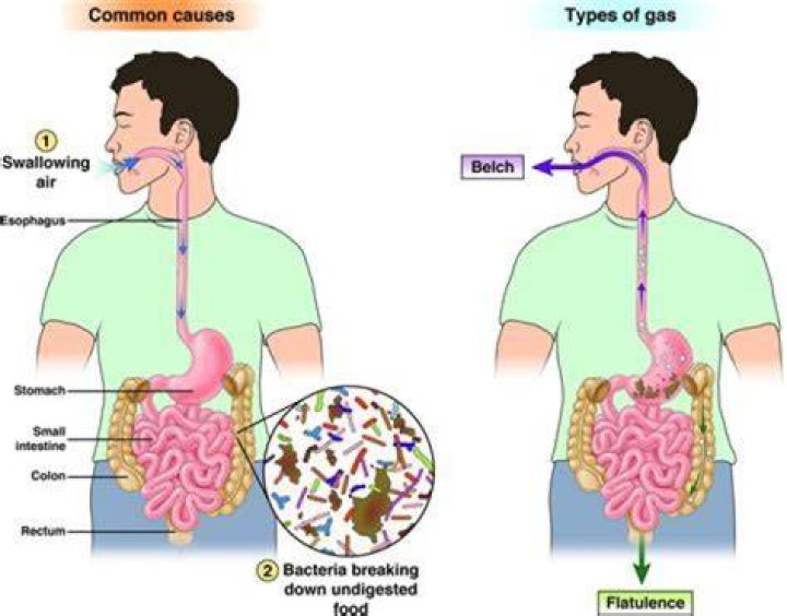 Does undigested food cause gas?