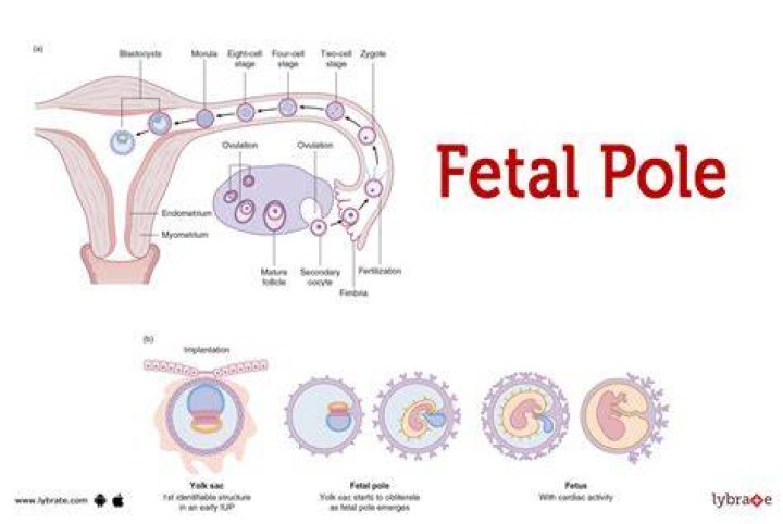 Whats a foetal pole?