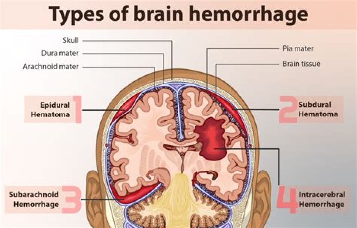 When does haemorrhage occur?