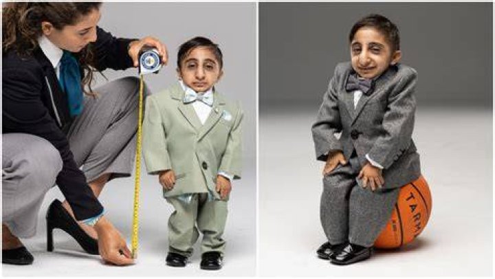 Who is the shortest person in the world?
